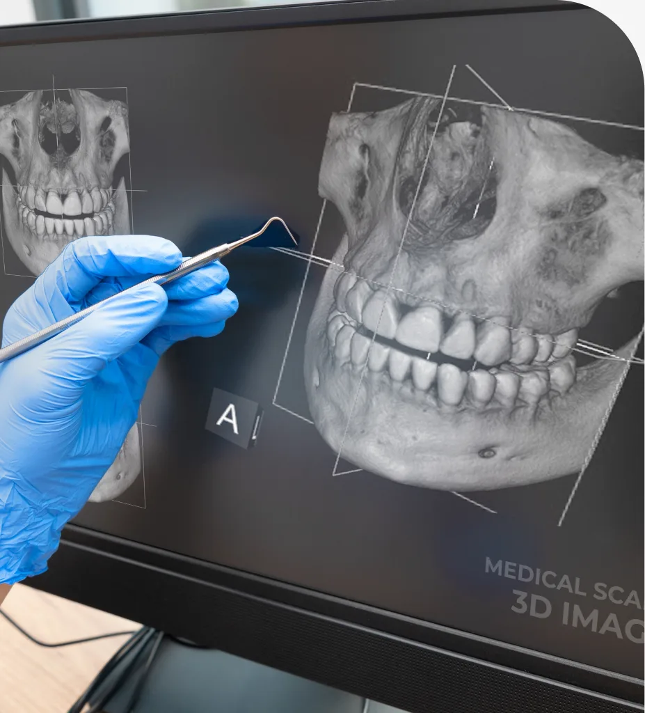 Panoramic X Rays at Centro Dental Las Americas