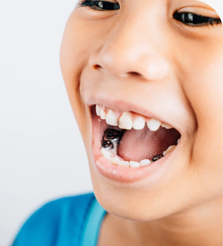 Preventive Dentistry at Centro Dental Las Americas