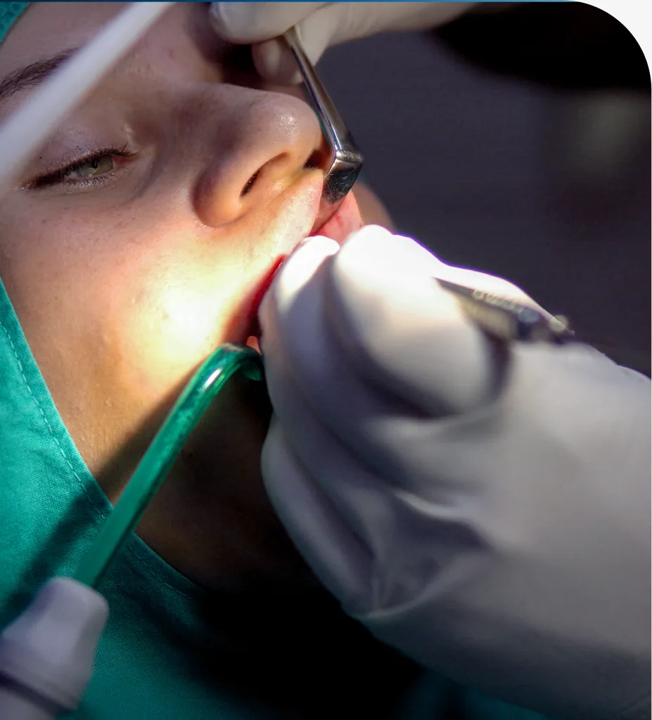 Tooth Extractions at Centro Dental Las Americas